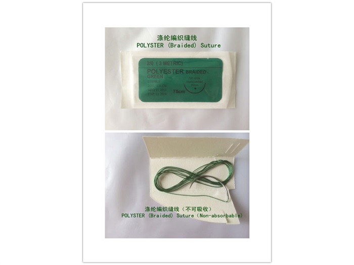 不銹鋼復(fù)合管護(hù)欄
